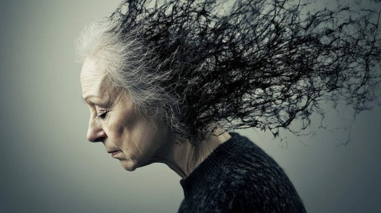 Sunki menopauze gali buti ispejamasis busimos demencijos pozymis